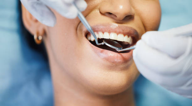 Best Emergency Dental Care for Sports Injuries in Garden Grove, FL